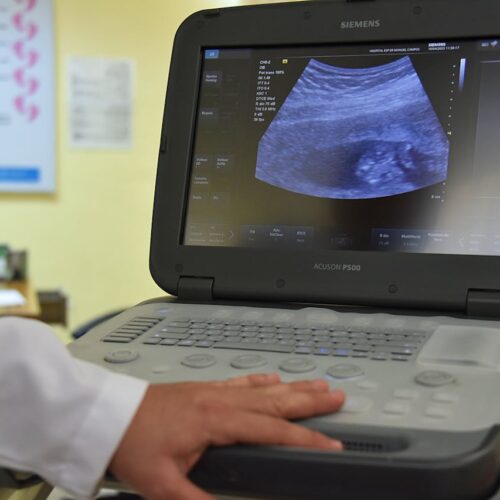 USG śledziony - diagnostyka, wskazania i przebieg badania